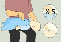 Từ vụ bé trai hóc nhãn phải sống thực vật: Bác sĩ chỉ cách sơ cứu cha mẹ nào cũng cần biết